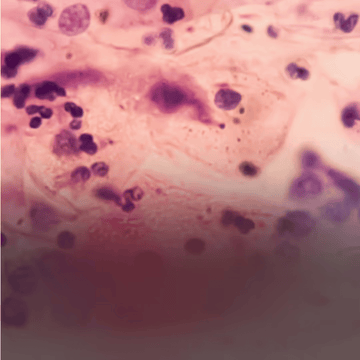 Visceral fat